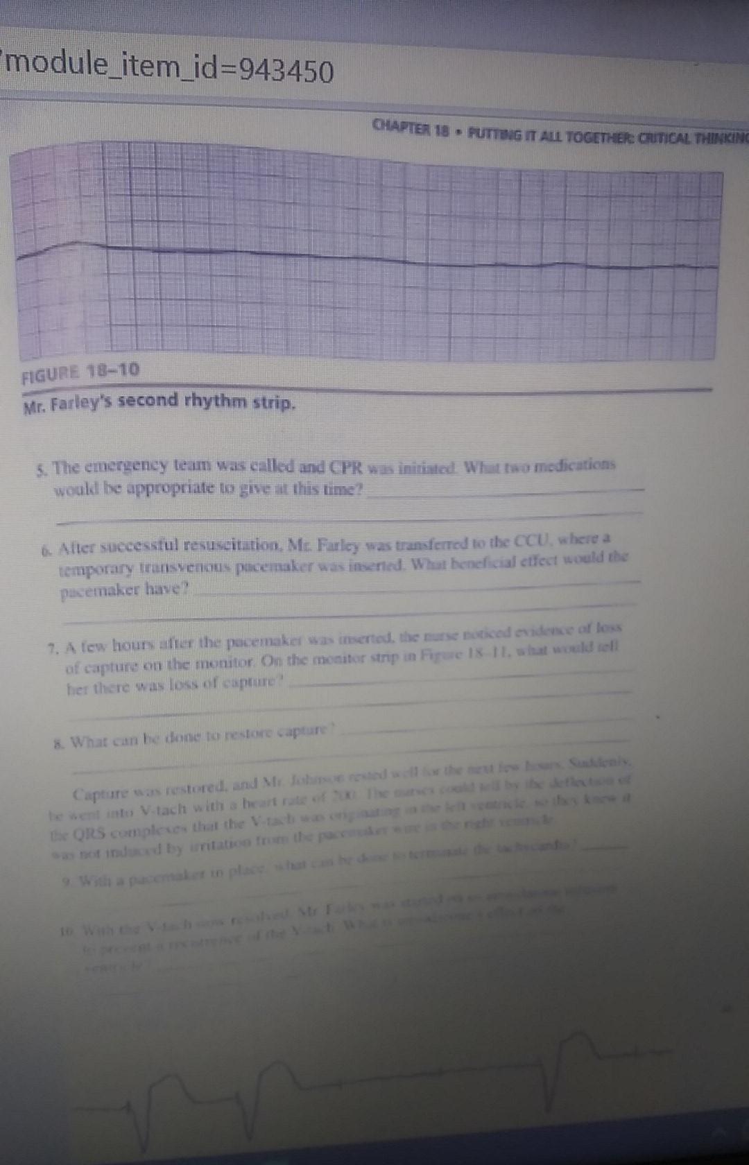 module_item_id=943450 CHAPTER 18 - PUTTING IT ALL TOGETHER CUTICAL THINKING FIGURE 18-10 Mr. Farleys second rhythm strip. 5.