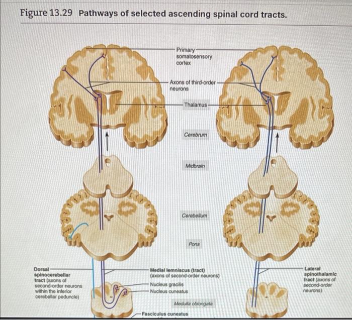 Solved Most somatosensory information decussates in the