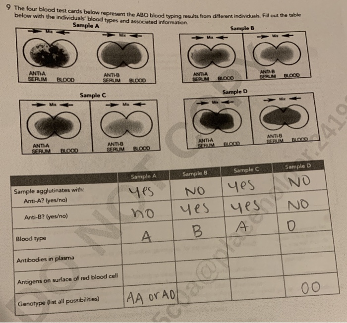 Solved Ur blood test cards below represent the ABO blood
