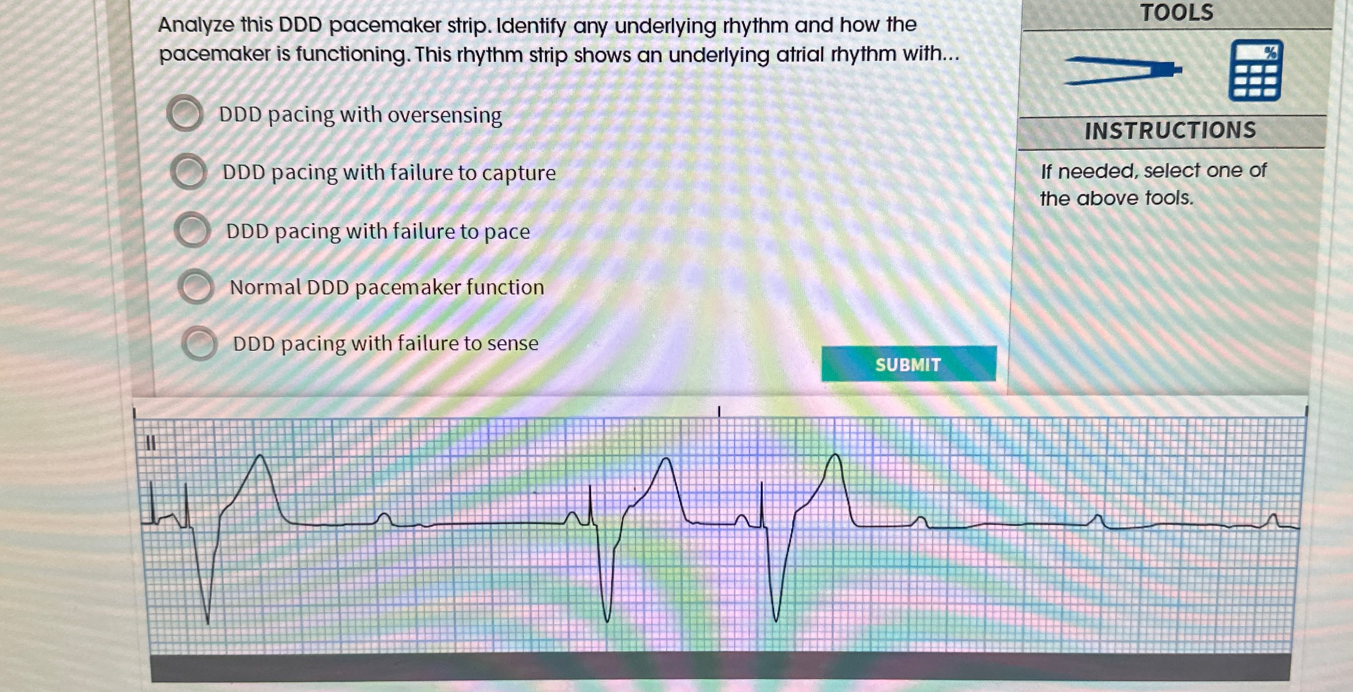 Solved Analyze this DDD pacemaker strip. Identify any | Chegg.com