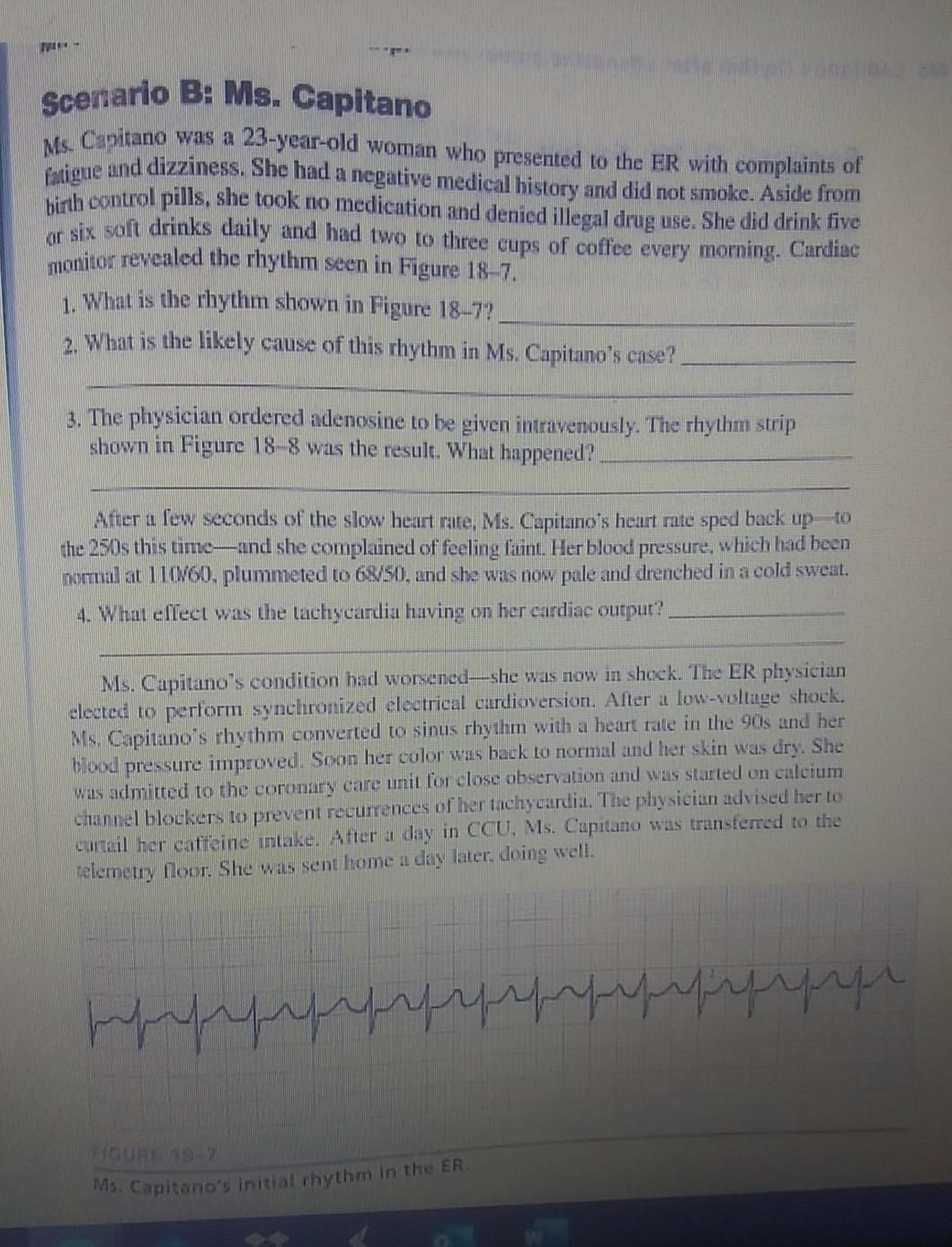 T- Scenario B: Ms. Capitano Ms. Capitano was a 23-year-old woman who presented to the ER with complaints of Pasigue and dizzi