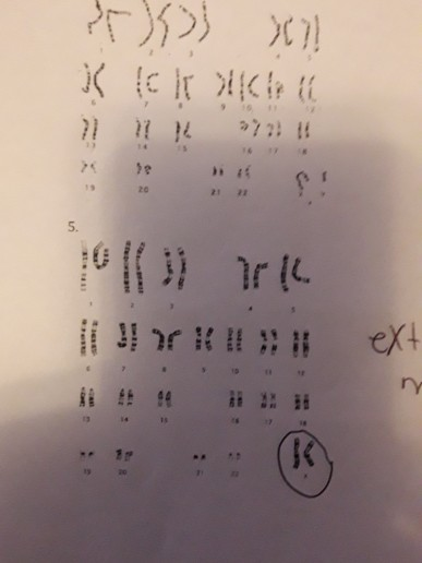 Solved Module 2 Lab (karyotypes) Activity Five Karyotypes 