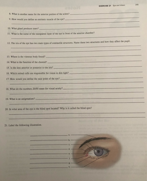 concussion flickery eyesight concussion flickery eyesight