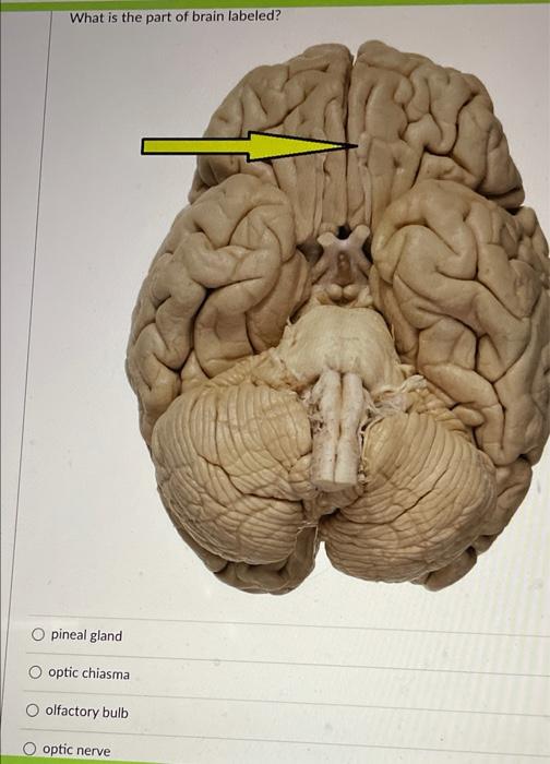 real brain labeled