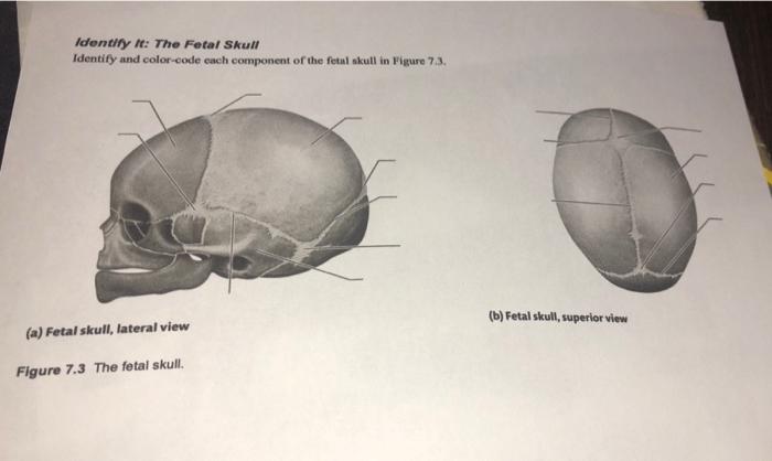 7.3 The Skull – Anatomy & Physiology