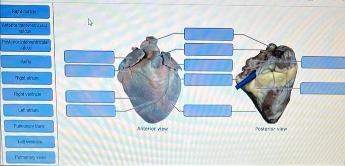 Right auricle
Anterior interventricular
sulcus
Posterior interventricular
sulcus
Aorta
Right atrium
Right ventricle
Left atri