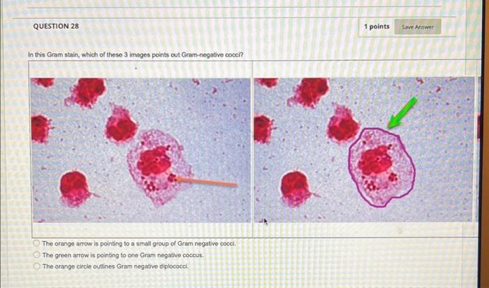 In this Gram stain, which of these 3 images points out Gram-negative cocci?
The orange arrow is poining to a small group of G