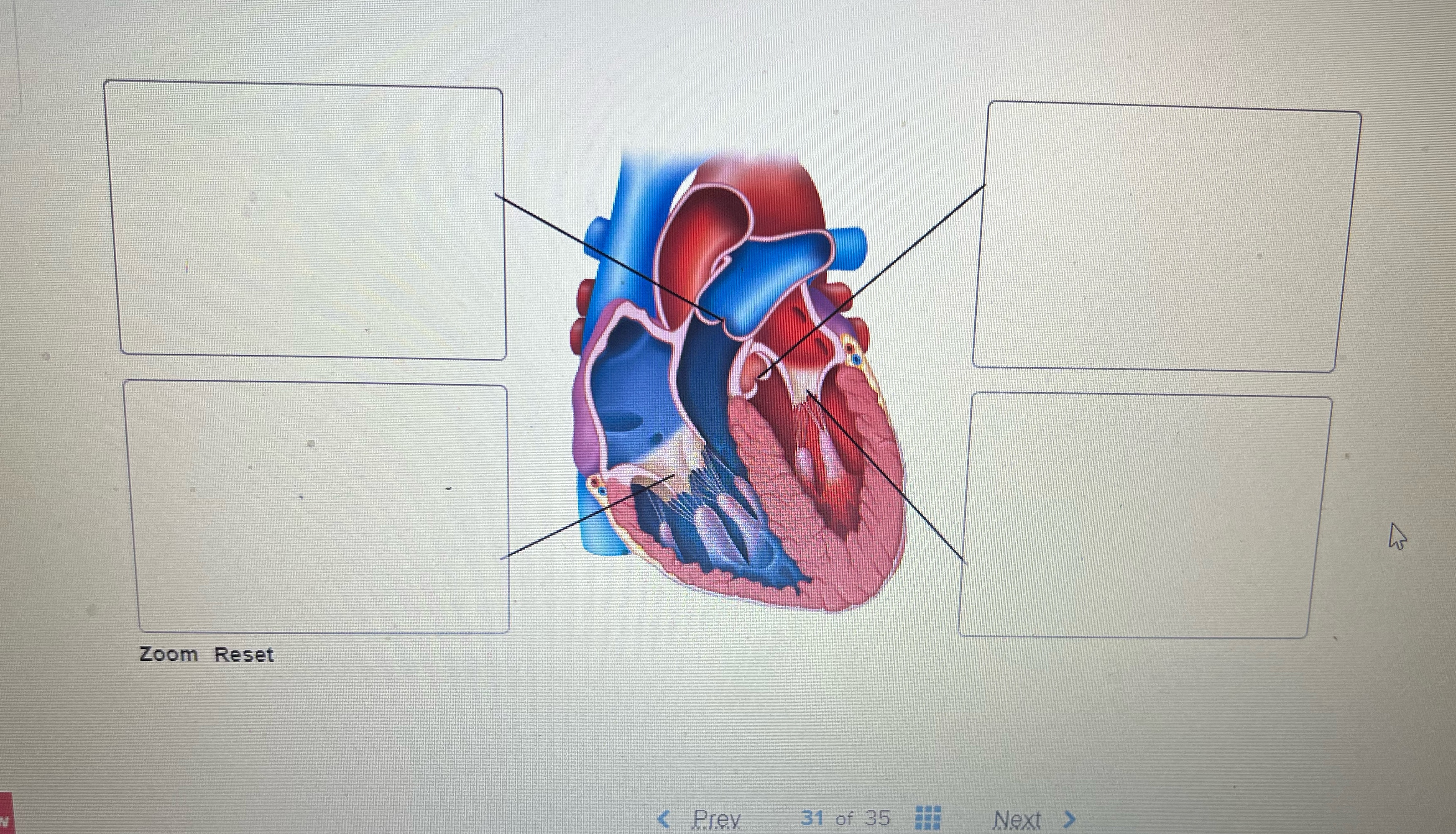 Identify the name(s) ﻿of each of the four valves of | Chegg.com