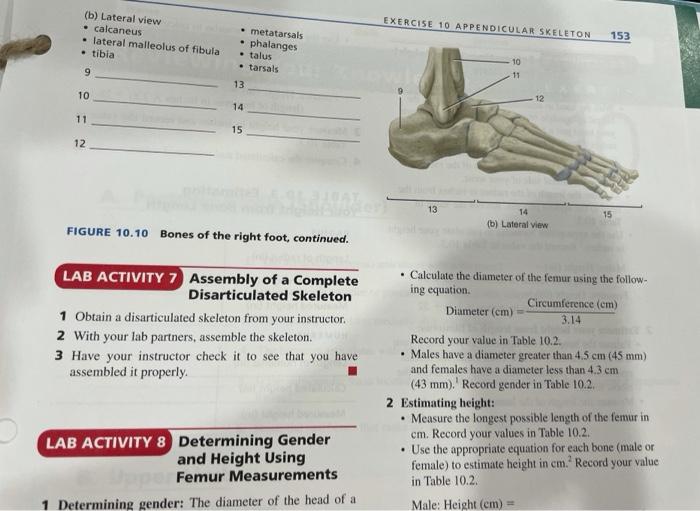 Solved EXERCISE 10 APPENDICULAR SKELETON (b) Lateral view •