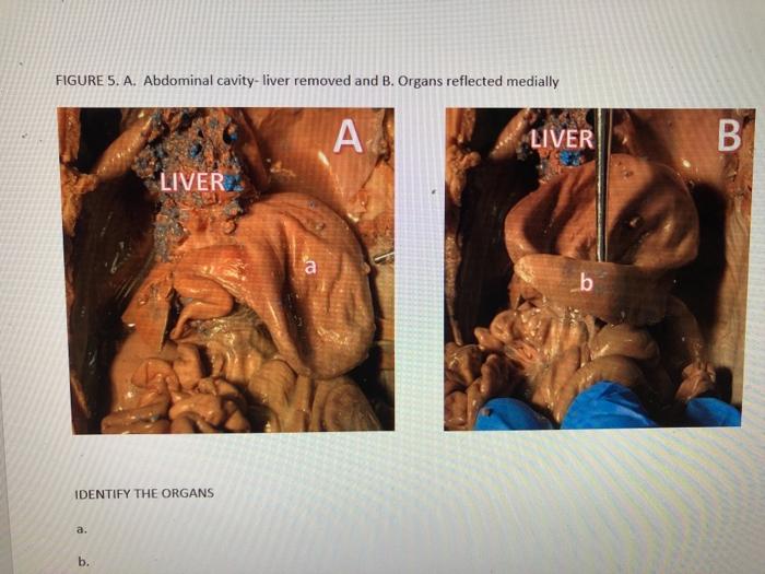 FIGURE 5. A. Abdominal cavity-liver removed and B. Organs reflected medially А. LIVER B LIVER a b IDENTIFY THE ORGANS a. b.