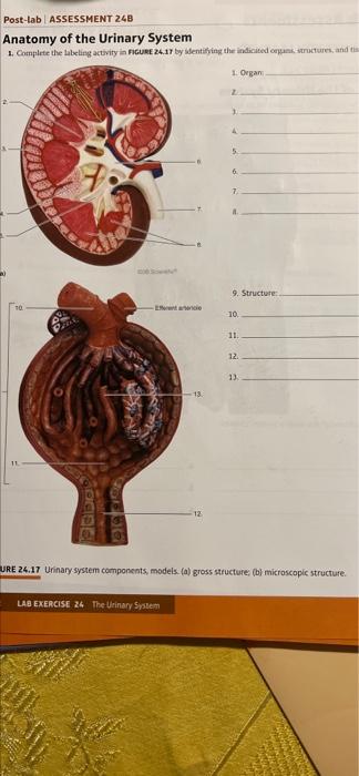 Post-lab ASSESSMENT 24B
Anatomy of the Urinary System
1. Complete the labeling activity in FIGURE 24.17 by identifying the in