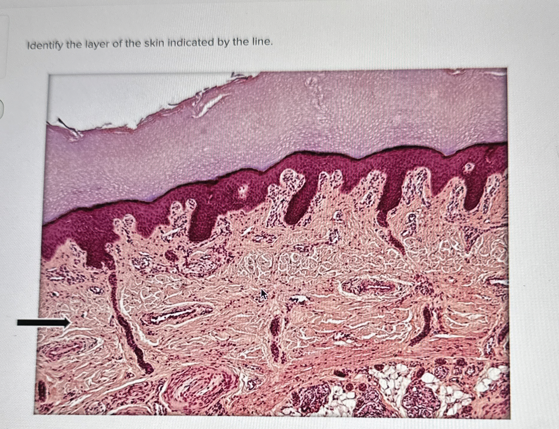 Solved Identify the layer of the skin indicated by the line. | Chegg.com
