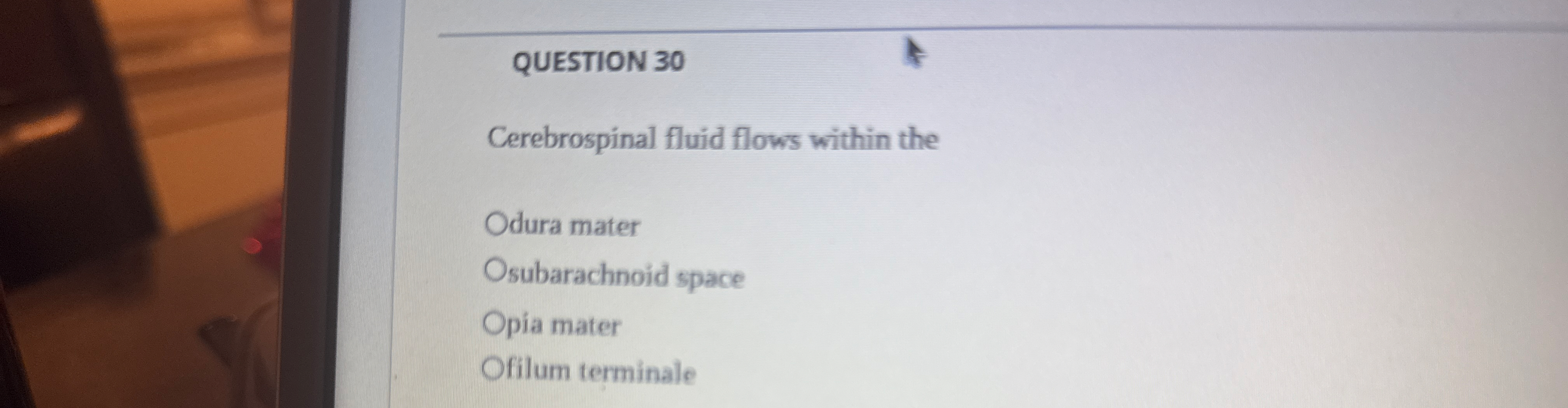 Solved Question Cerebrospinal Fluid Flows Within Thedura Chegg Com