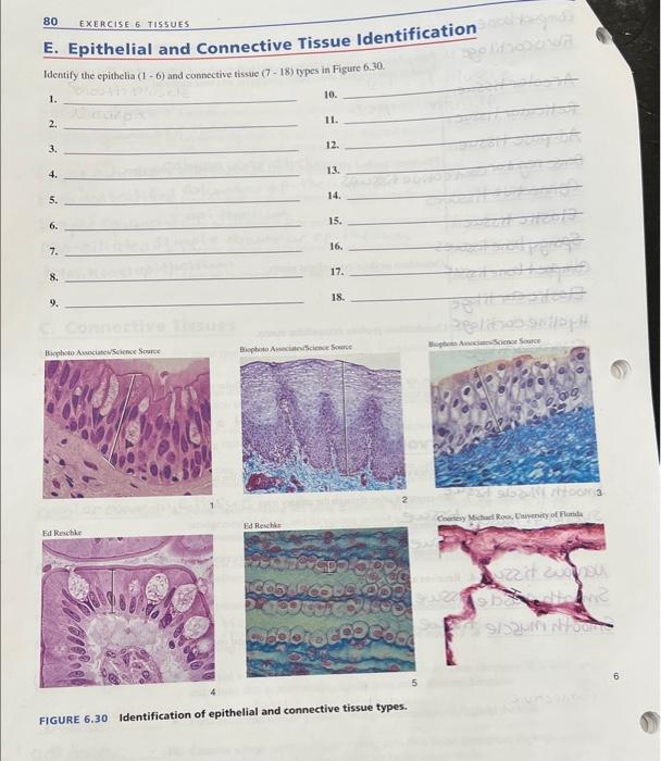 Solved 80 Exercise 6 Tistues E Epithelial And Connective 4448