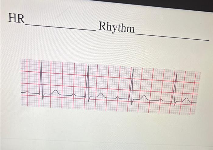 HR Rhythm | Chegg.com