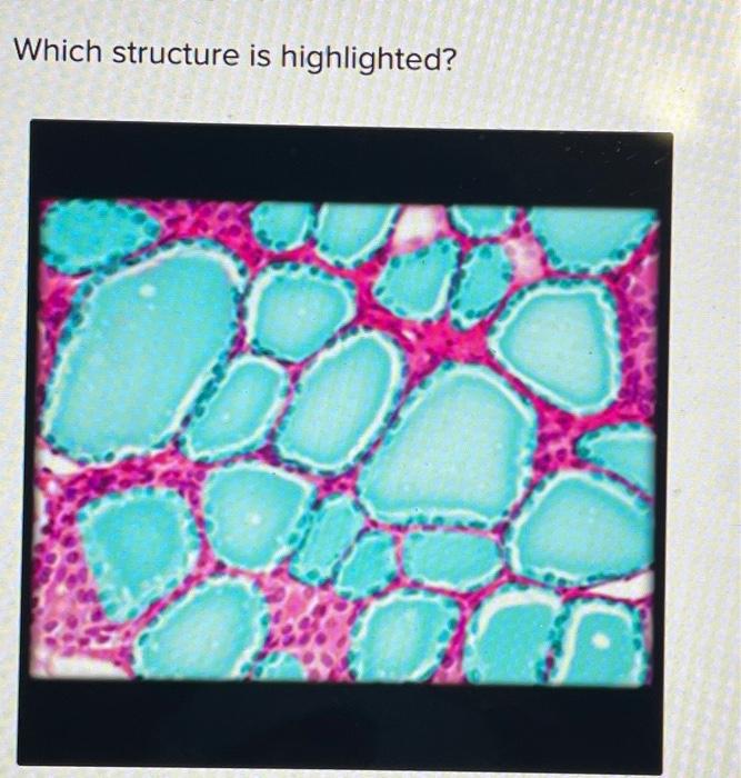 Solved Which structure is highlighted? Multiple Choice c | Chegg.com