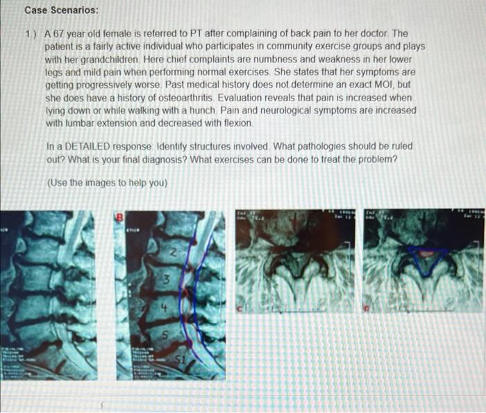 Solved Case Scenarios: 1.) A 67 year old female is referred | Chegg.com
