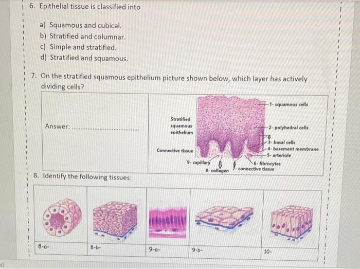 Solved 6. Epithelial tissue is classified into a) Squamous | Chegg.com