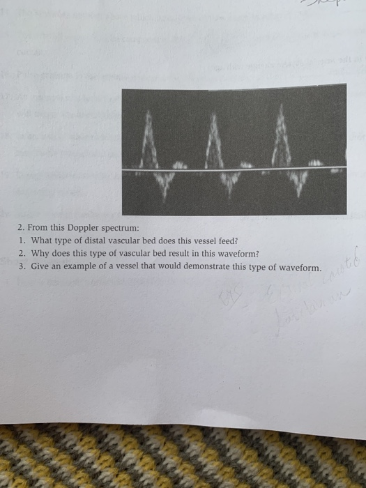 Solved 2. From this Doppler spectrum 1. What type of distal