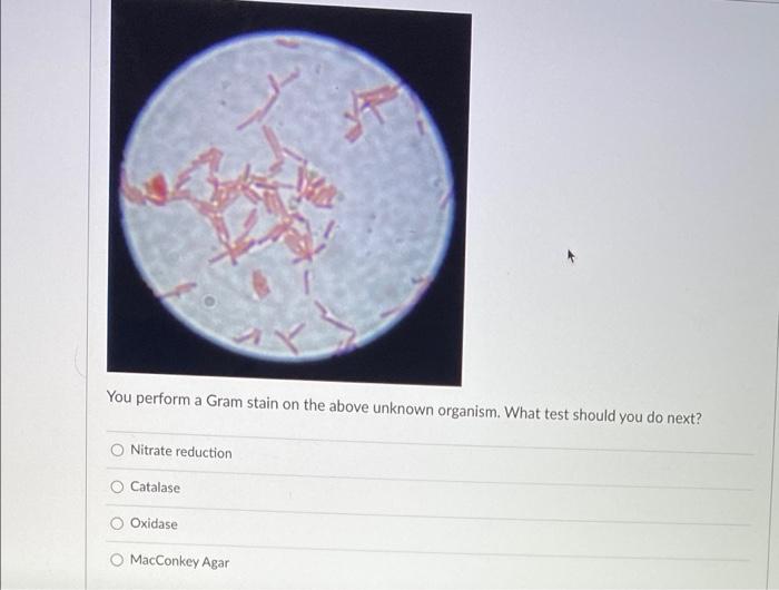 Solved You perform a Gram stain on the above unknown | Chegg.com