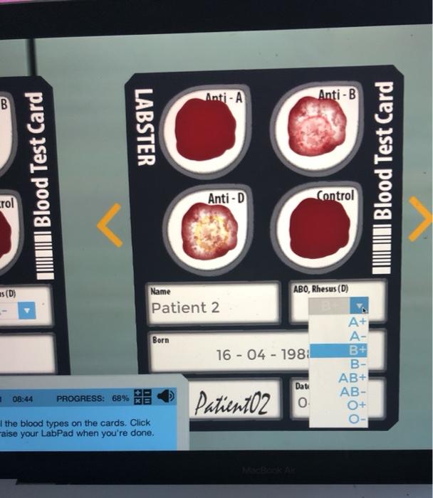 Solved AntiA AntiB B LABSTER Tuin Blood Test Card o o