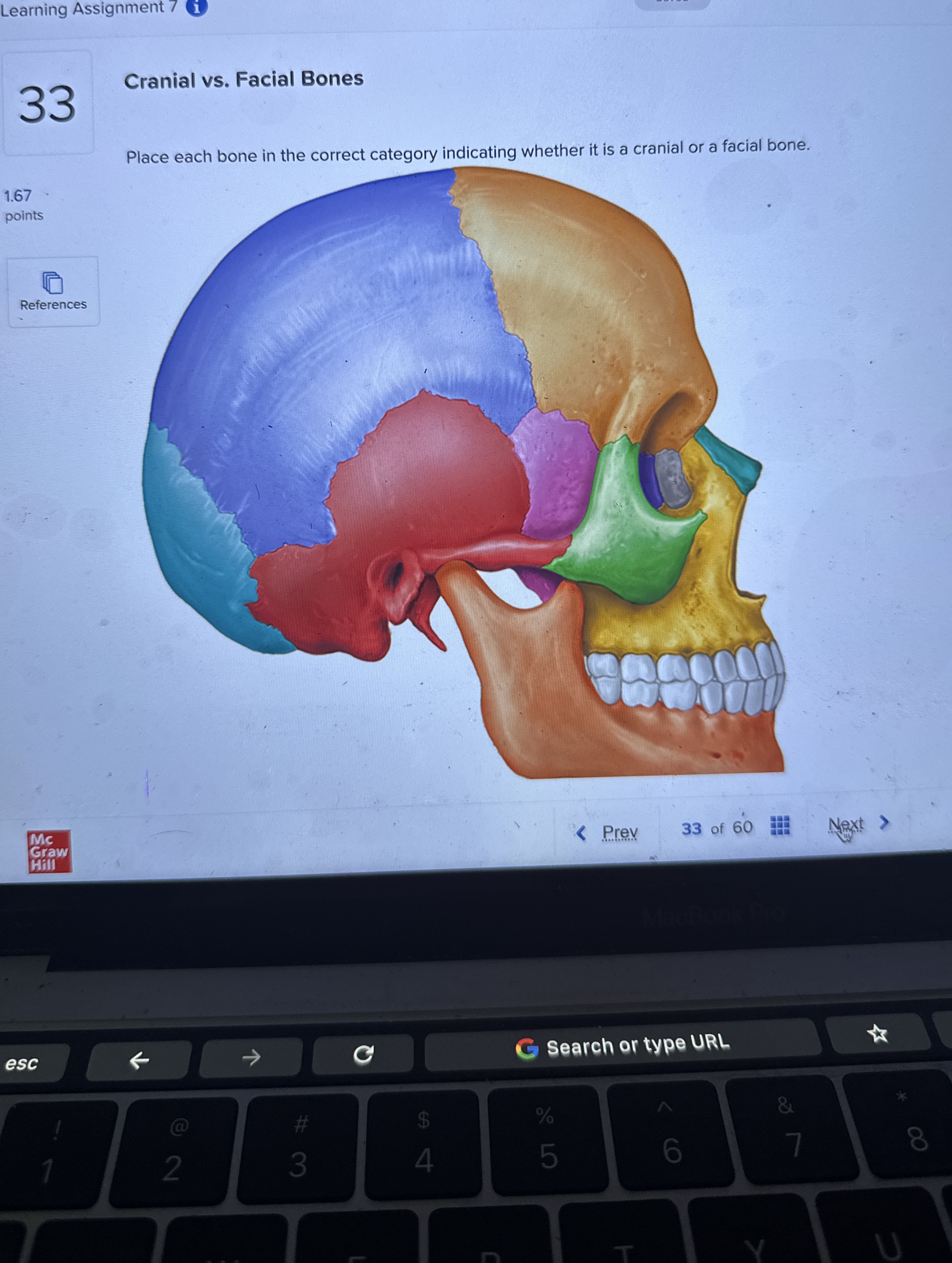 Solved Cranial vs. ﻿Facial BonesPlace each bone in the