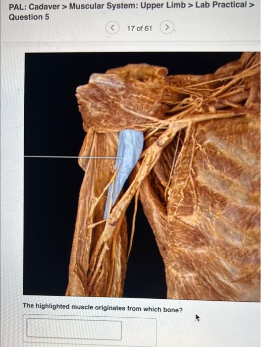 The upper limbs, Human Anatomy and Physiology Lab (BSB 141)