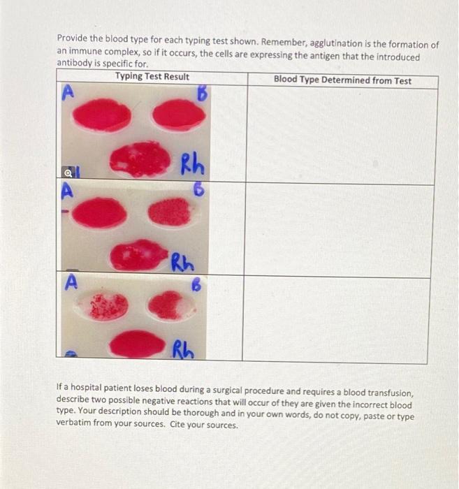 Solved Provide the blood type for each typing test shown. | Chegg.com