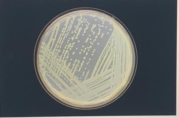 Solved Answer should include: Shape: Circular colonies | Chegg.com
