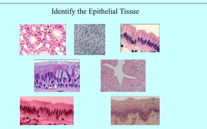 Solved Identify the Epithelial Tissue | Chegg.com