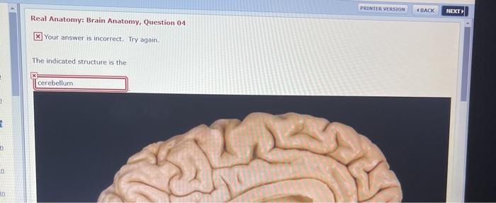 PUNTER VERSION « (BACK NEXT Real Anatomy: Brain Anatomy, Question 04 x Your answer is incorrect. Try again. The indicated str