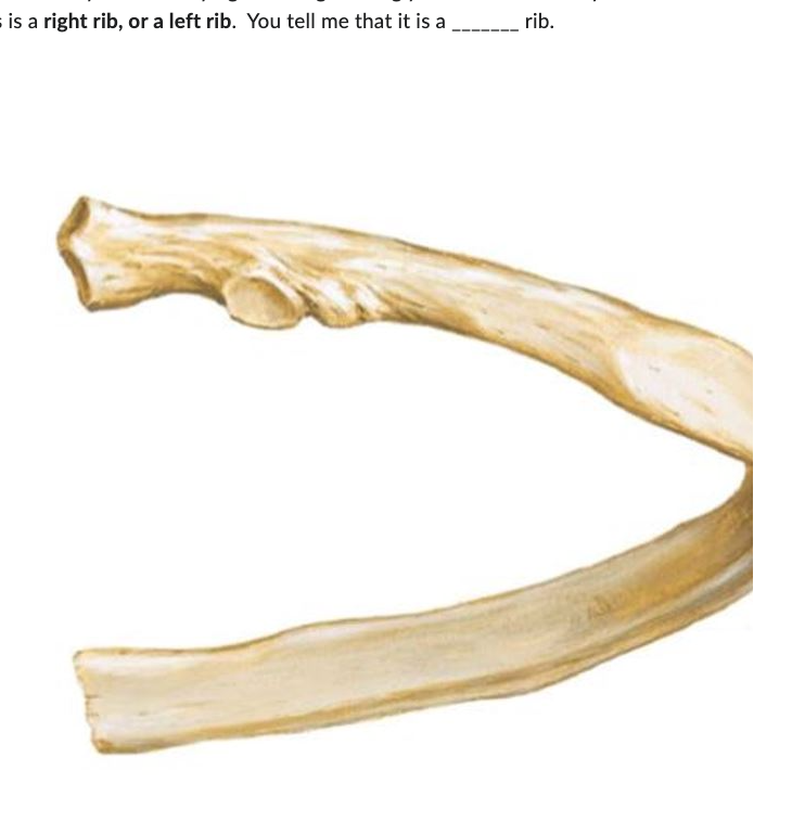 Solved is a right rib, or a left rib. You tell me that it is | Chegg.com