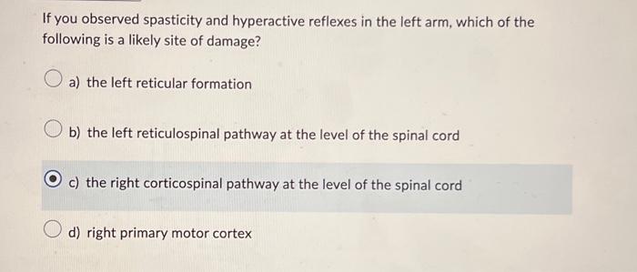 Solved Which of the following accurately describes how upper | Chegg.com