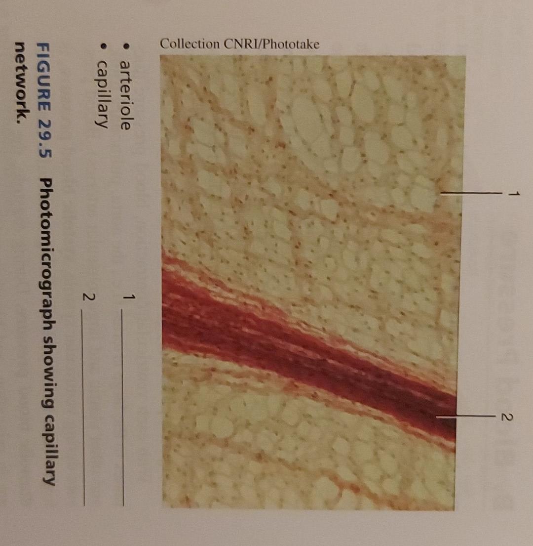 Solved basement membrane endothelium external elastic
