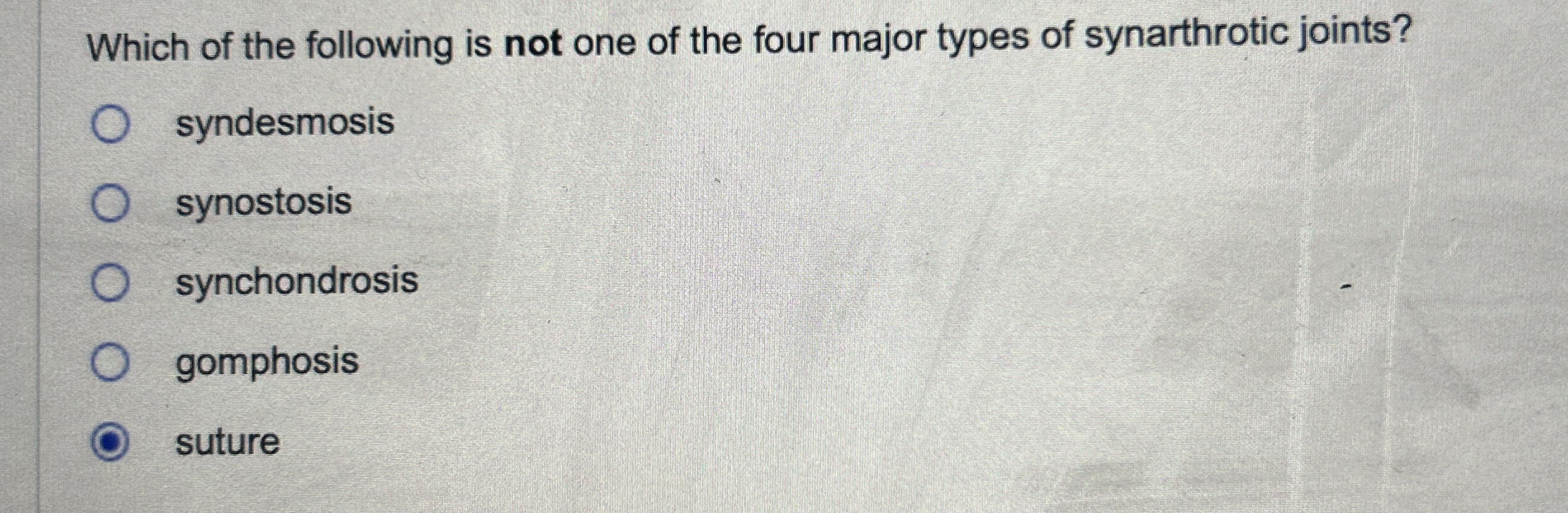 Solved Which of the following is not one of the four major
