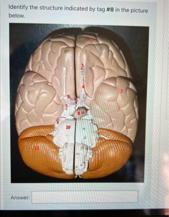 Solved Identify the structure highlighted green in the | Chegg.com