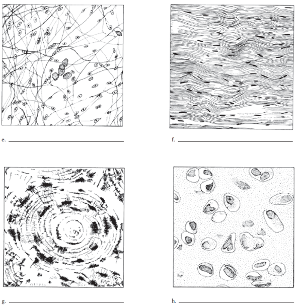 Write the name of each tissue type in illustrations a t... | Chegg.com