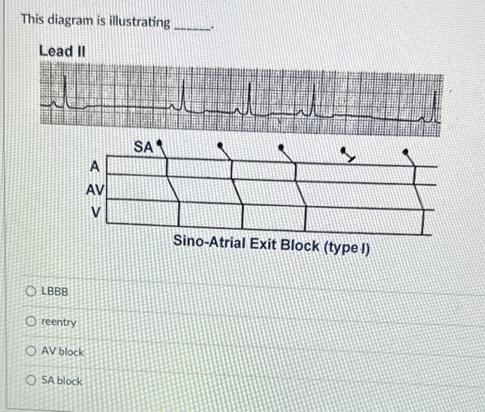 Solved This diagram is illustrating L 4 \( \hdashline \) | Chegg.com