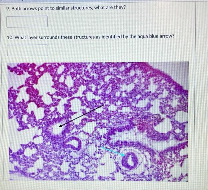 9. Both arrows point to similar structures, what are | Chegg.com