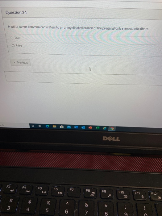 Solved Question 34 A white ramus communicans refers to an | Chegg.com