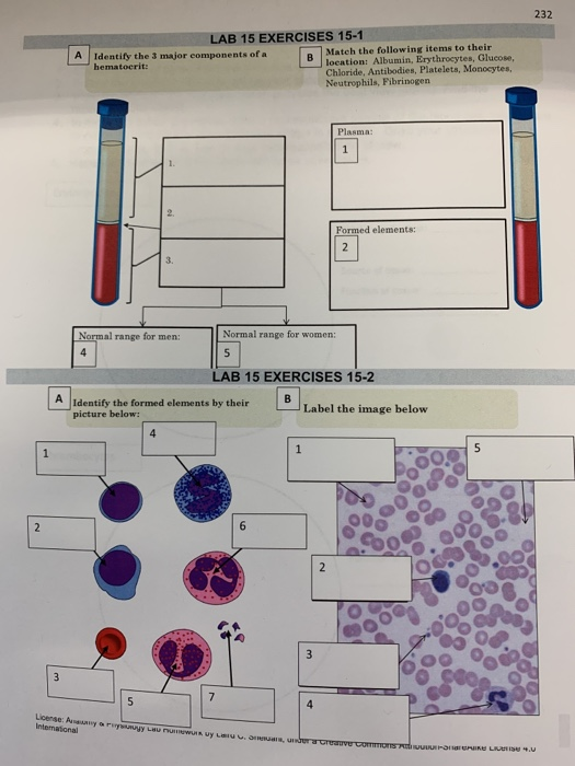 Solved 232 A LAB 15 EXERCISES 15-1 Identify The Major | Chegg.com