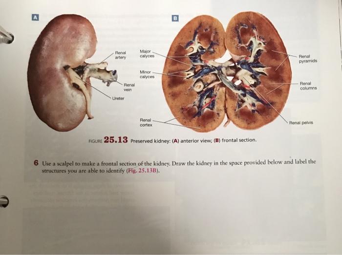 Solved Procedure 4 Kidney Dissection In this exercise you