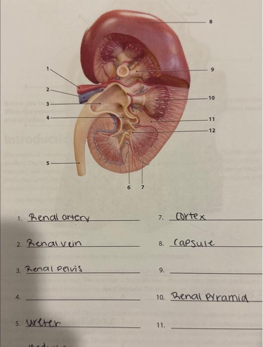 1. Renal artery
7. cortex
2. Renalvein
8. Capsule
3. Renal Pelvis
9.
4.
10. Renal pyramid
5. ureter
11.