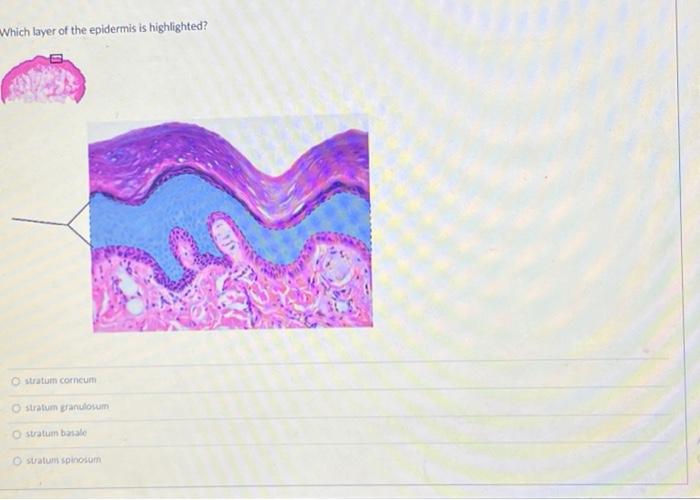 Solved Which layer of the skin is highlighted? O papillary | Chegg.com