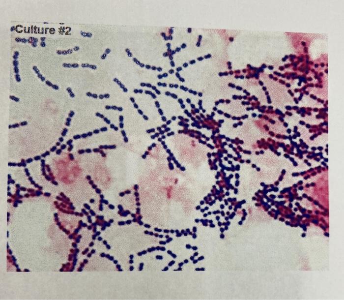Solved 1)A) pink rods gram negative B)purple rods gram | Chegg.com