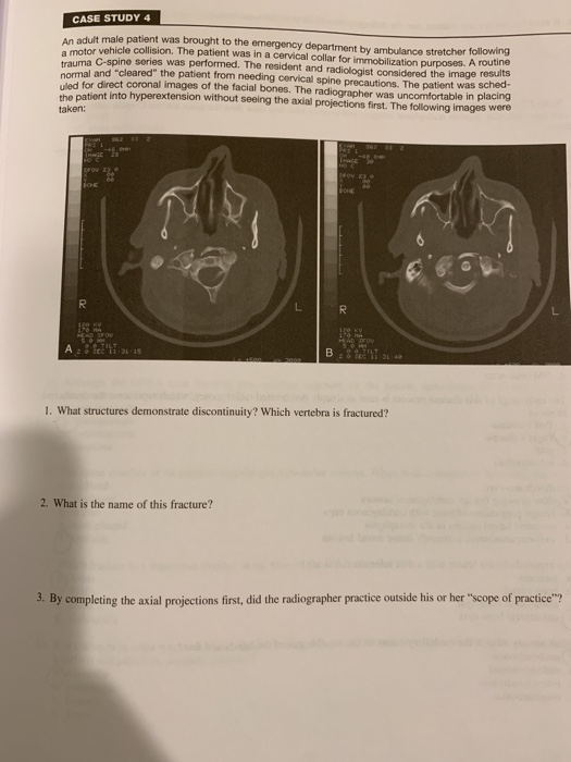 Solved CASE STUDY 4 adult male patient was brought to the | Chegg.com