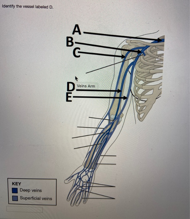 Solved Identify the vessel labeled B. A- B- Arm Arteries C | Chegg.com