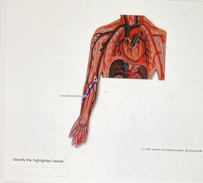 Identify the highlighted vessel. For th LT VB128 Head