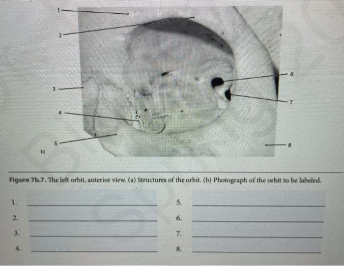 Solved 2 3 b) Figure 7b.7. The left orbit, anterior view. | Chegg.com