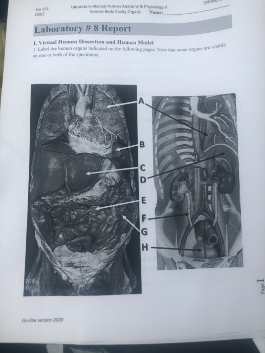 Solved SPRINUS Bio 151 DCCC Laboratory Manual Human Anatomy Chegg